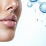 can hyaluronic acid clog pores?
